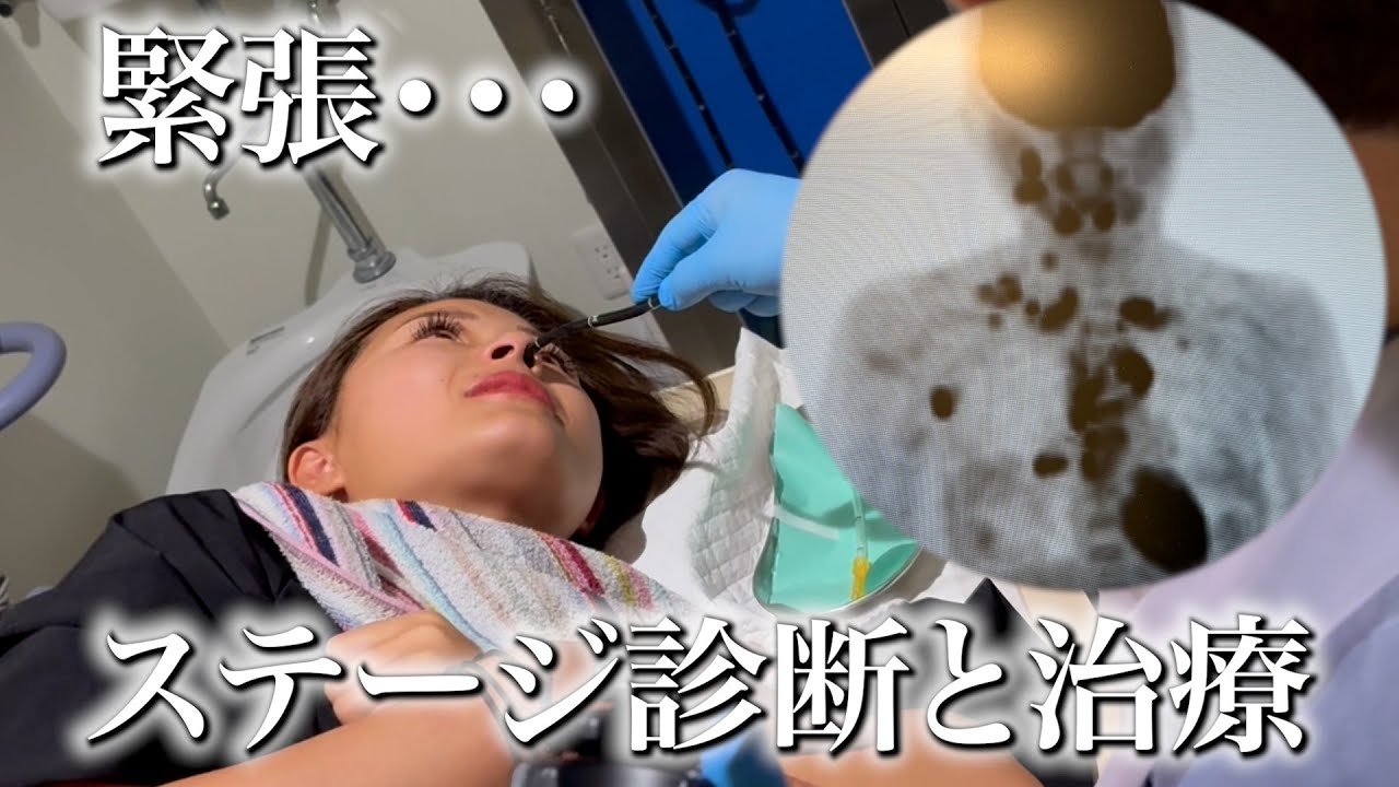 運命のステージ診断…結果はステージ◯でした。【今後の治療について】