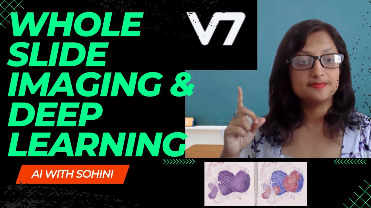 Deep Learning for Whole Slide Imaging | Preprocessing and Annotating WSI Datasets with V7