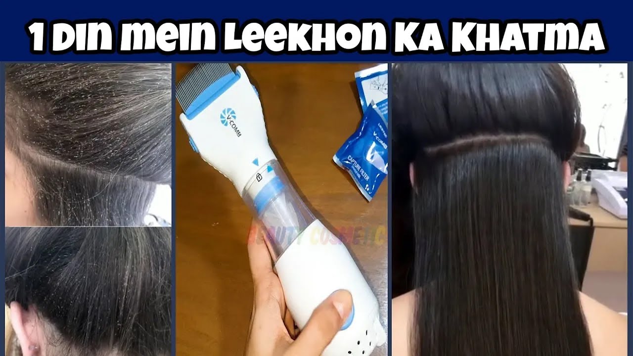 How to Use V comb head lice Machine | Lice & nits جوئیں یا لکھیں خاتم کرنے کا طریقہ