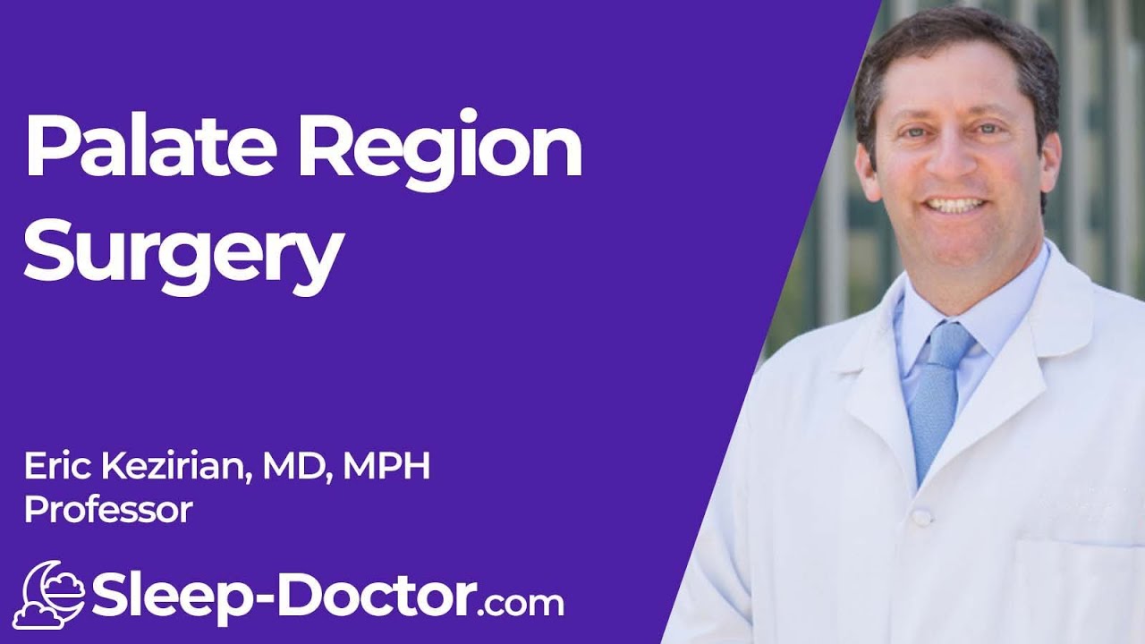 Snoring and Obstructive Sleep Apnea 5: Palate Region Surgery