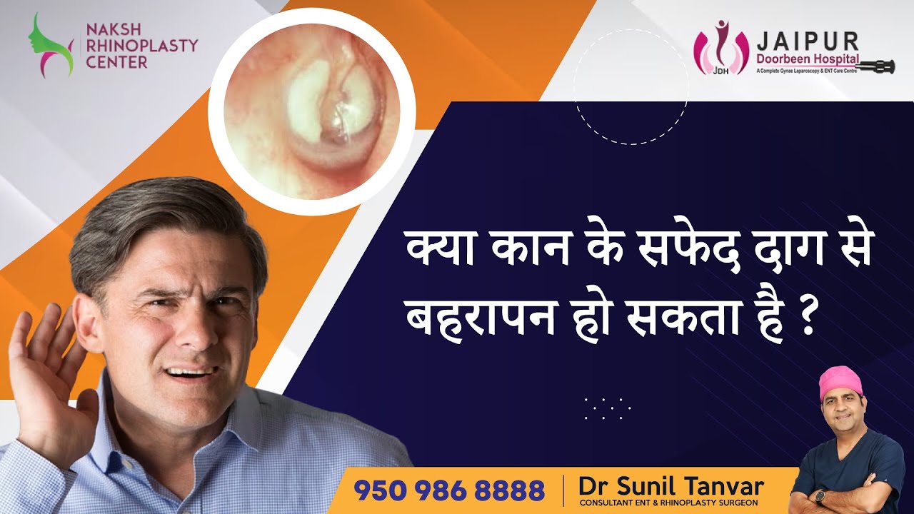 कान के परदे पर सफेद दाग और बहरापन के कारण | TYNPANOSCLEROSIS क्या है? | नये उपचार के साथ