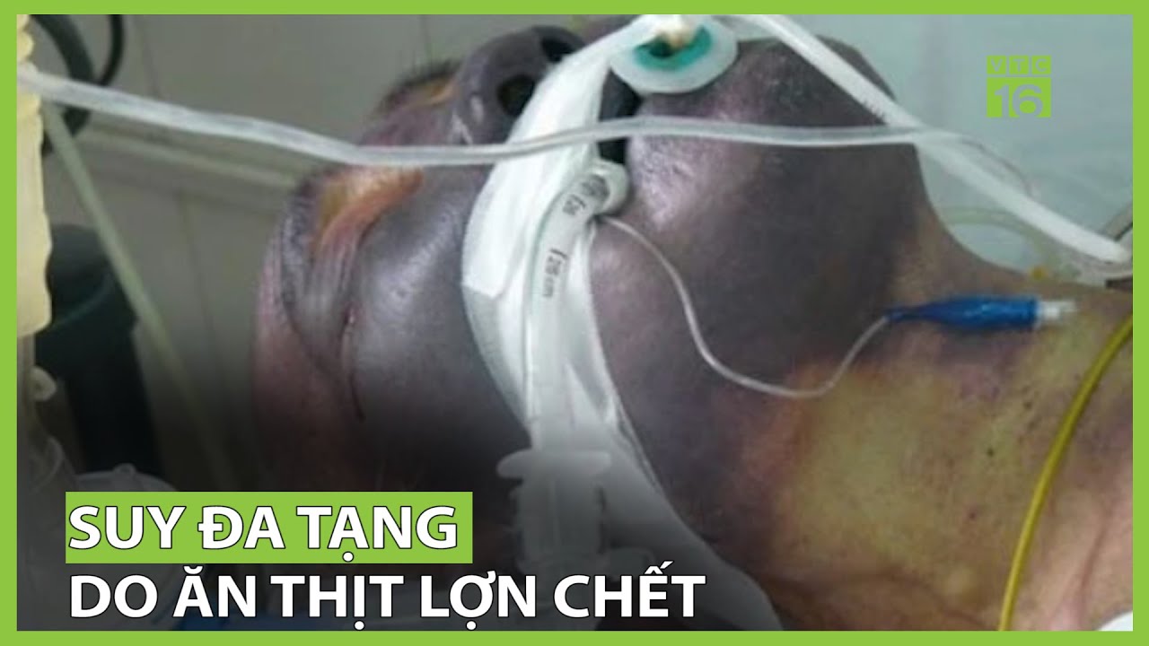 Suy đa tạng do ăn thịt lợn chết | VTC16