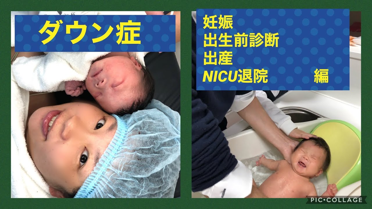 【ダウン症】妊娠中　出生前診断　出産　NICU入院退院　編