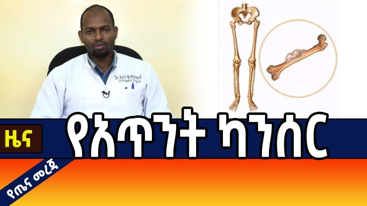 ጤና መረጃ - የአጥንት ካንሰር
