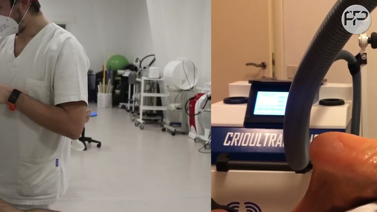 Fisioterapia a Roma - A cosa serve il crioultrasuono?