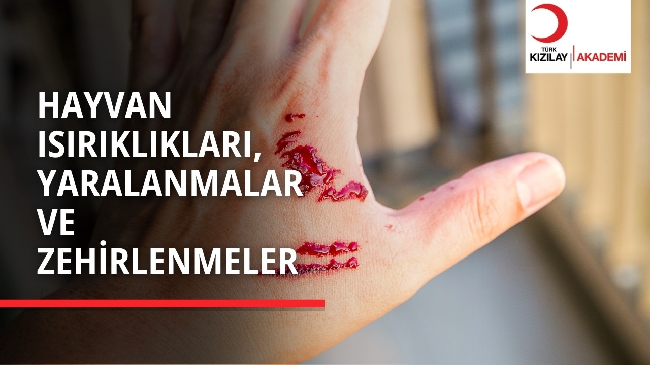 Arı mı Soktu, Denizanası mı? | Yanlış Müdahale Etmeyin!