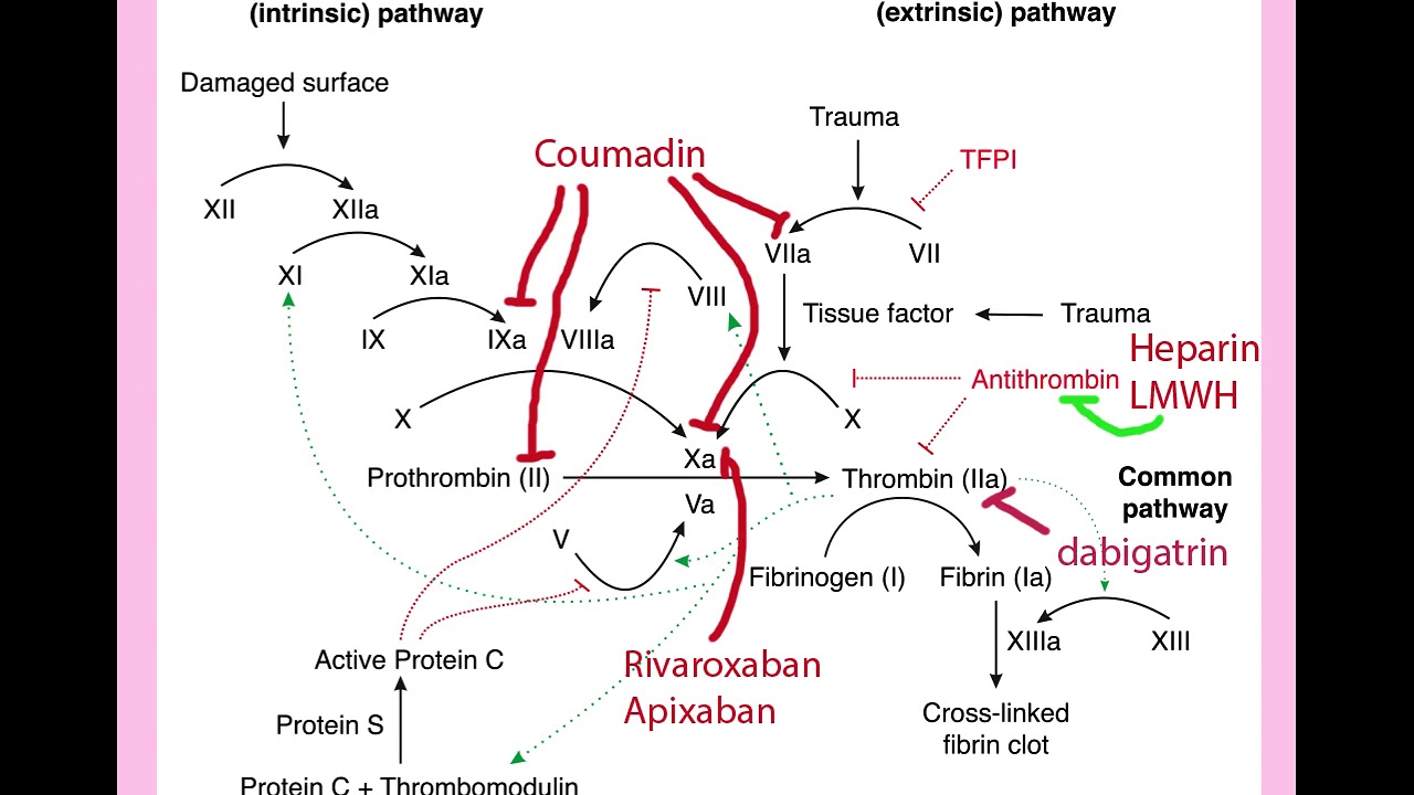 Thrombophilia in Pregnancy - CRASH! Medical Review Series