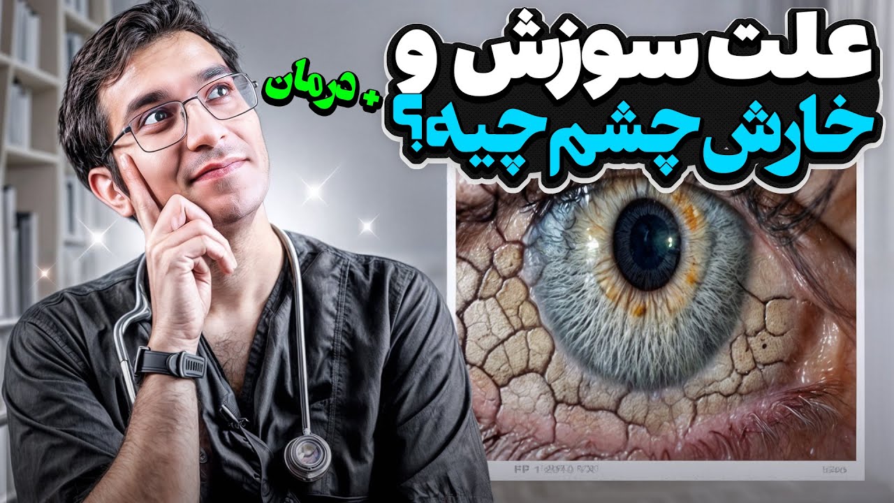 علت سوزش چشم و انواع راه‌های درمان آن