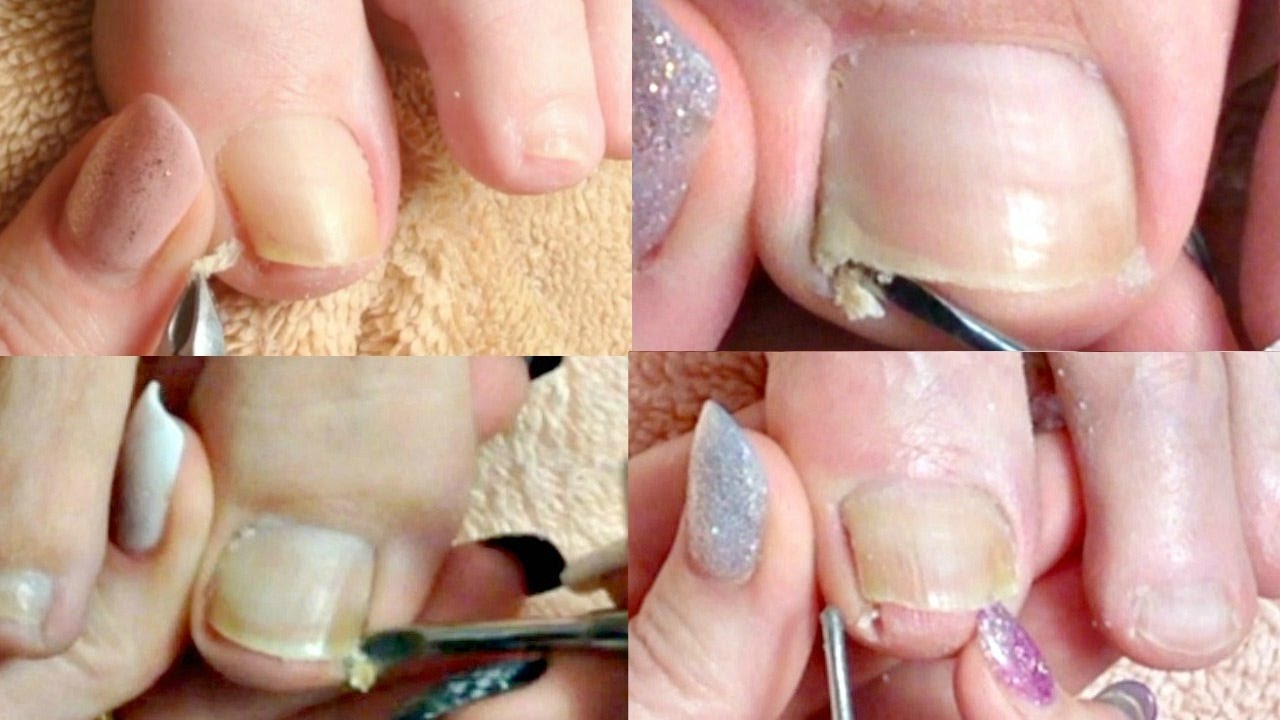 #1 Pedicure Tutorial Big Toenail Cleaning Compilation Real Time ✔