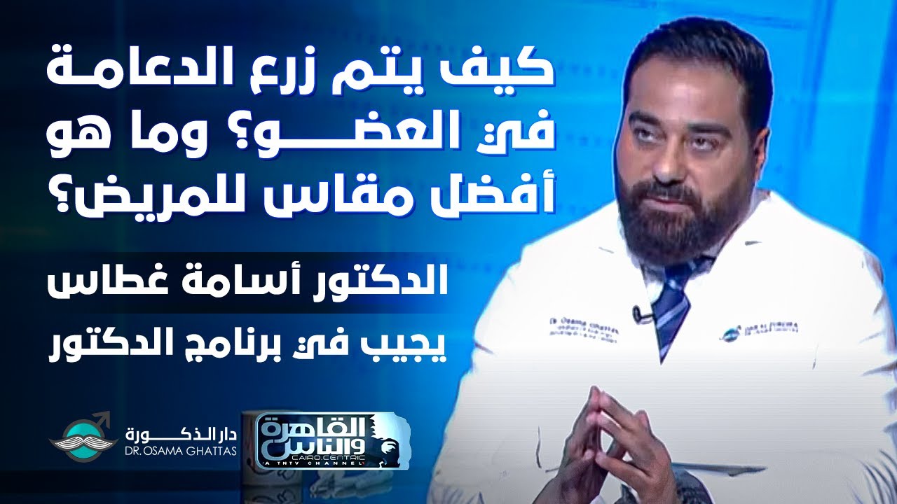 كيف يتم زرع الدعامة في العضو؟ وما هو أفضل مقاس للمريض؟ | الدكتور أسامة غطاس يجيب