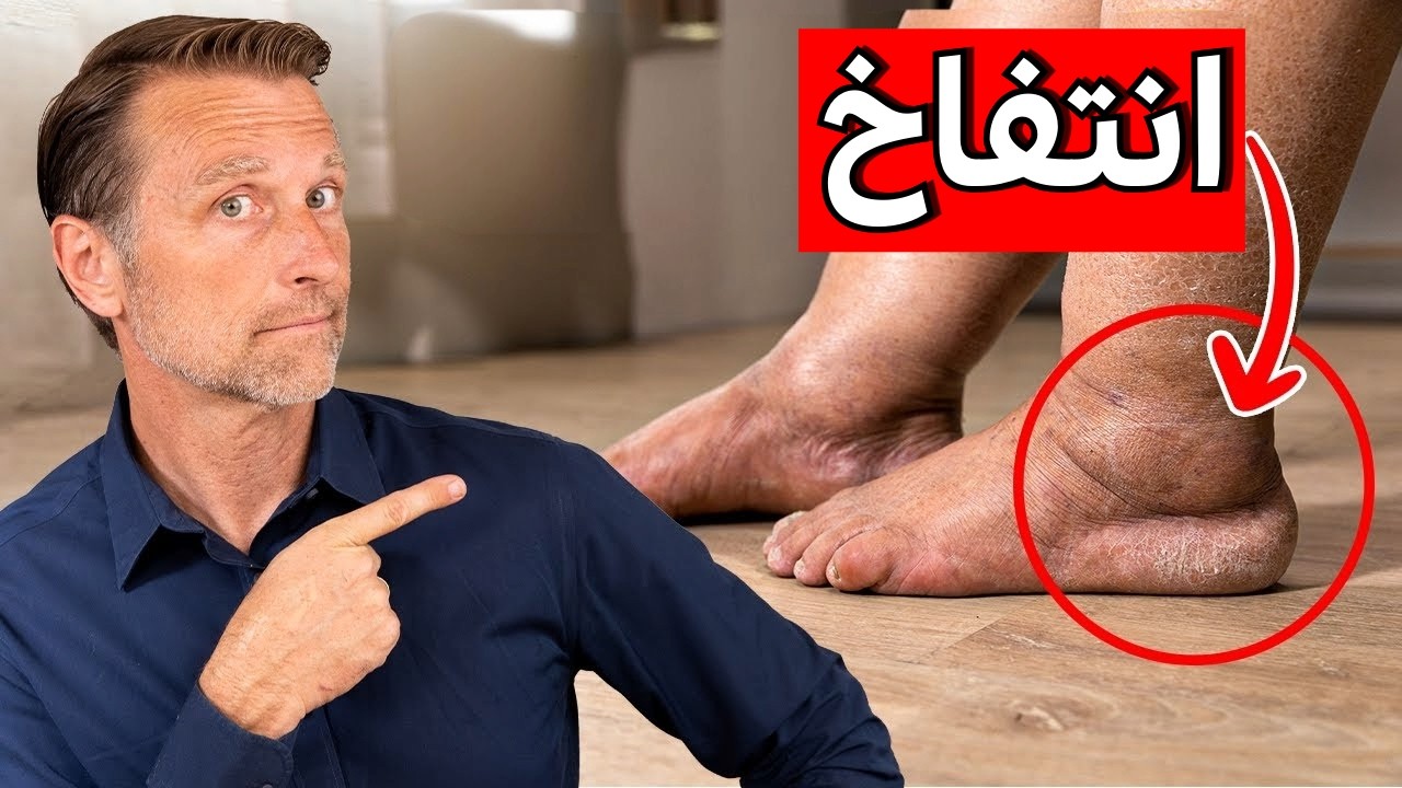 الفيتامين الأول للقضاء على تورم وانتفاخ الساقين والكاحلين