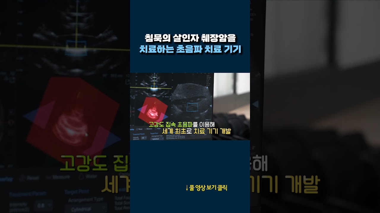 췌장암, 초음파 치료기기 #shorts