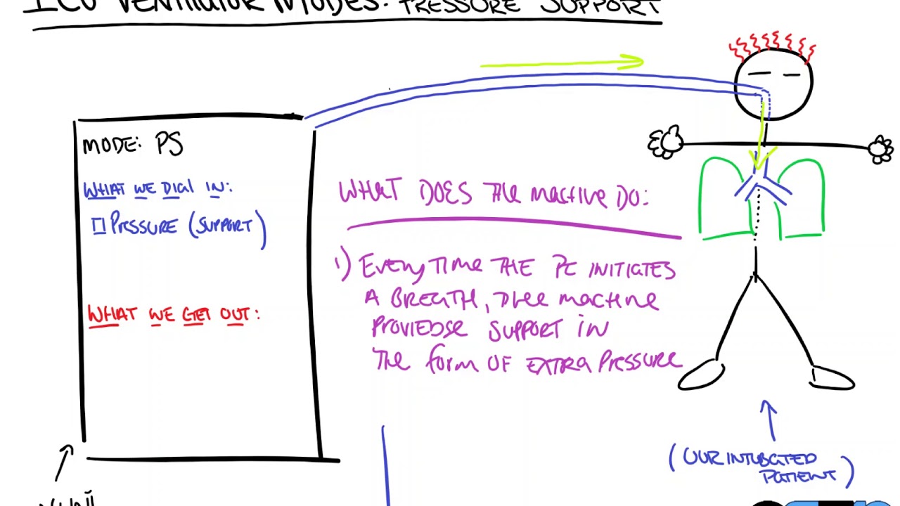 Pressure Support