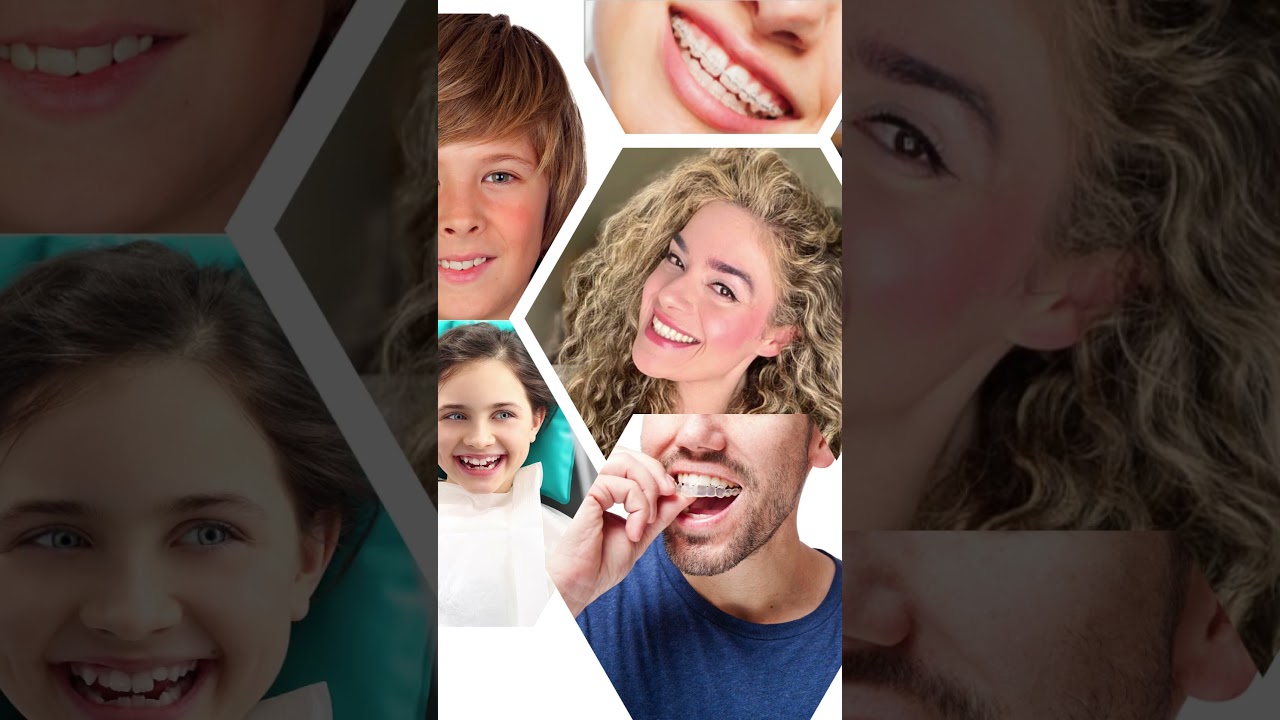 Super Orthodontics: Your one Bringing Smiles to Encino, Los Angeles, CA #invisalignexpert
