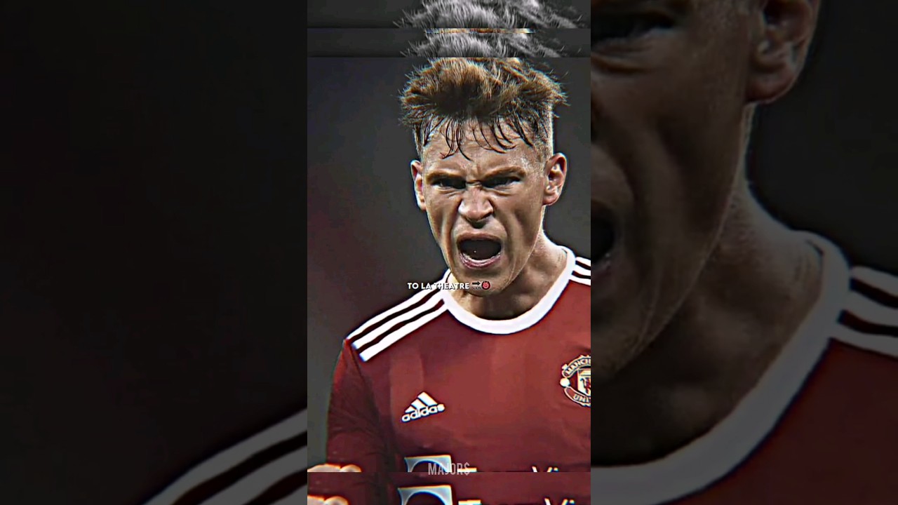Joshua Kimmich Welcome To Manchester United 😱🔥#shorts