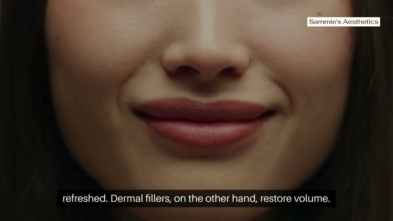 Botox & Filler in New Braunfels, TX: Best Aftercare for Great Results