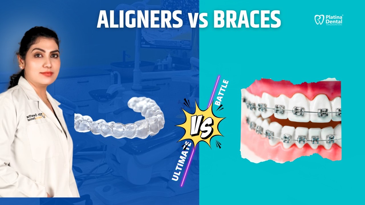 Braces vs Aligners | Which Is Best for Teeth Alignment? | Cost Comparison Telugu | Hyderabad Dentist