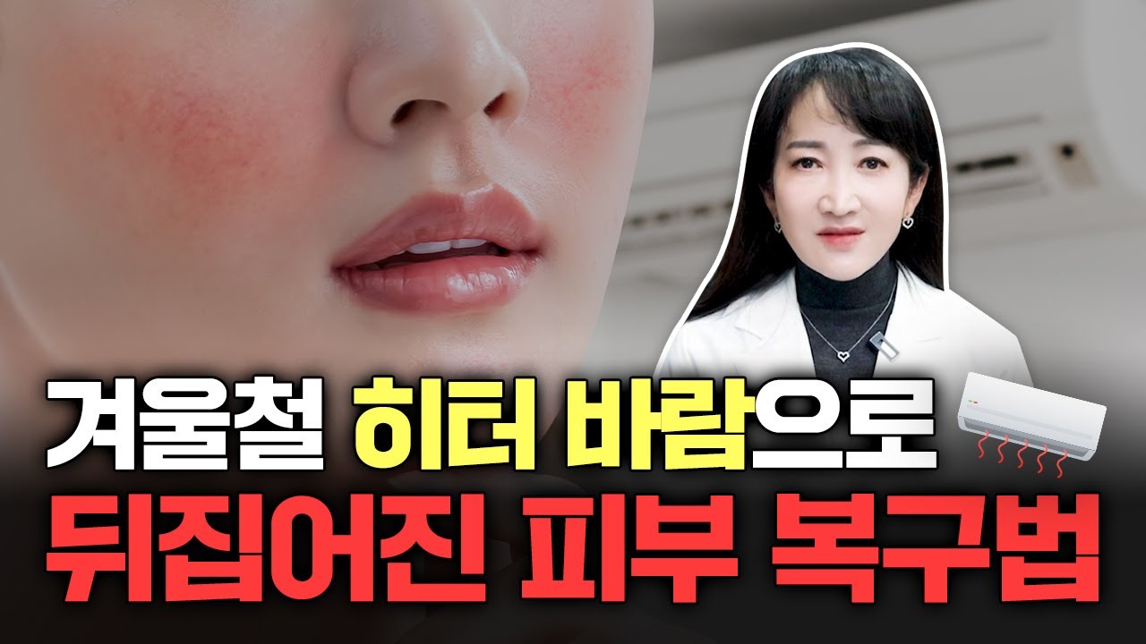 히터 바람에 망가진 피부, 겨울철 피부 복구법 공개 [망가진피부 ㅣ 겨울철피부복구법]