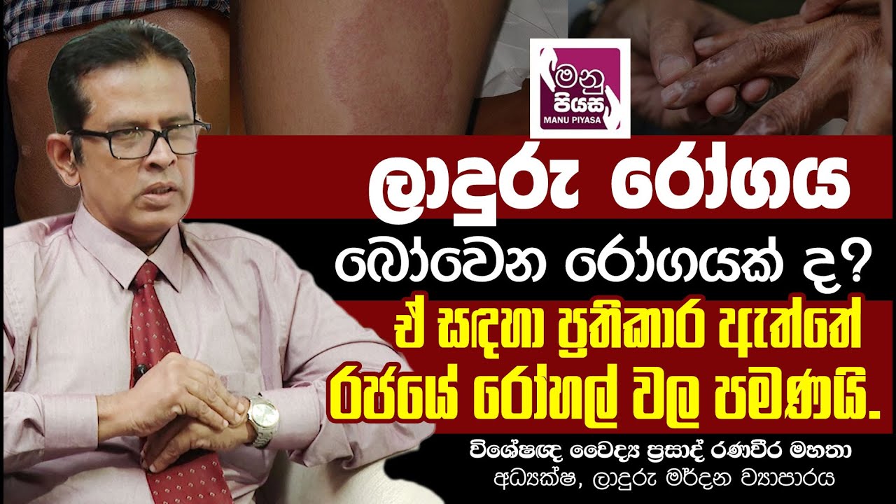 ලාදුරු රෝගය බෝවෙන රෝගයක් ද? | ඒ සඳහා ප්‍රතිකාර ඇත්තේ රජයේ රෝහල් වල පමණයි..