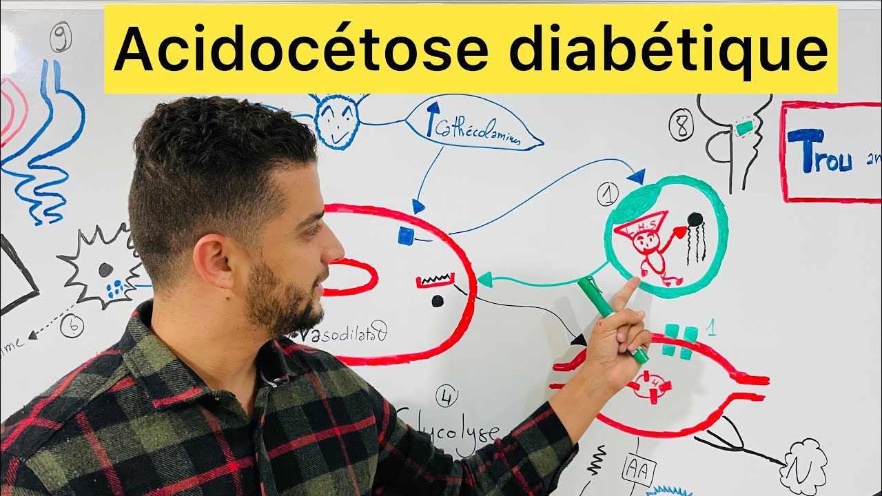Acidocétose diabétique