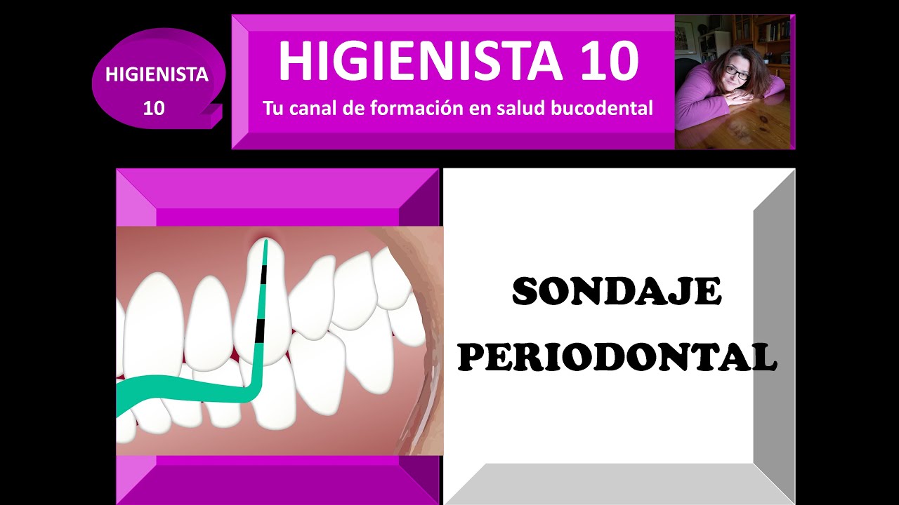 SONDAJE PERIODONTAL. TEMARIO GENERAL 25.