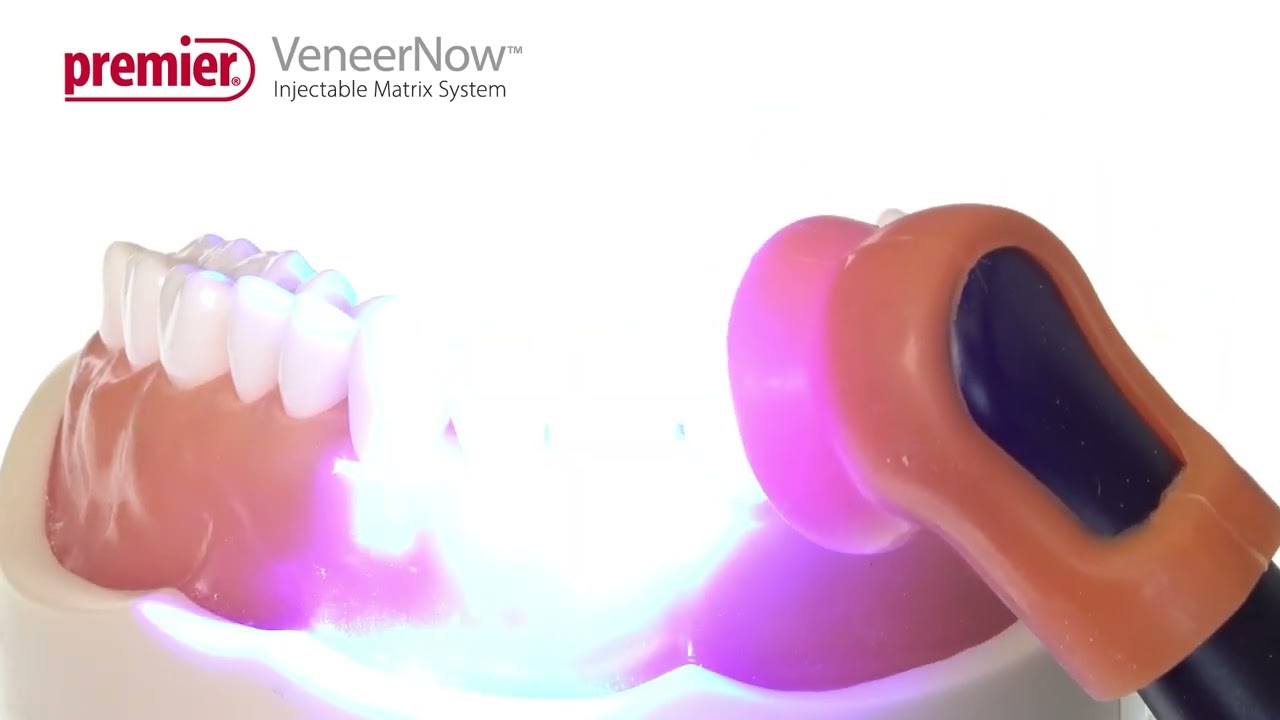 VeneerNow&trade; Injectable Matrix System - Create Chairside Composite Veneers
