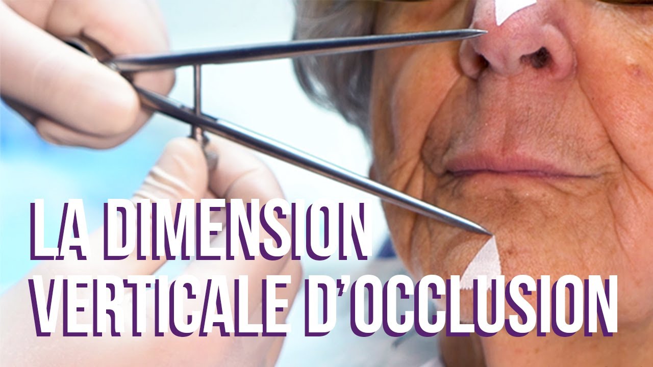 Tuto Prothèse #2 – La dimension verticale d’occlusion