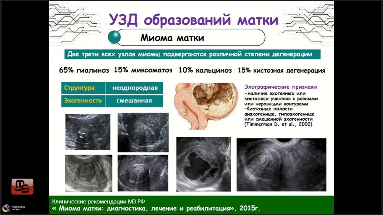 Вебинар 