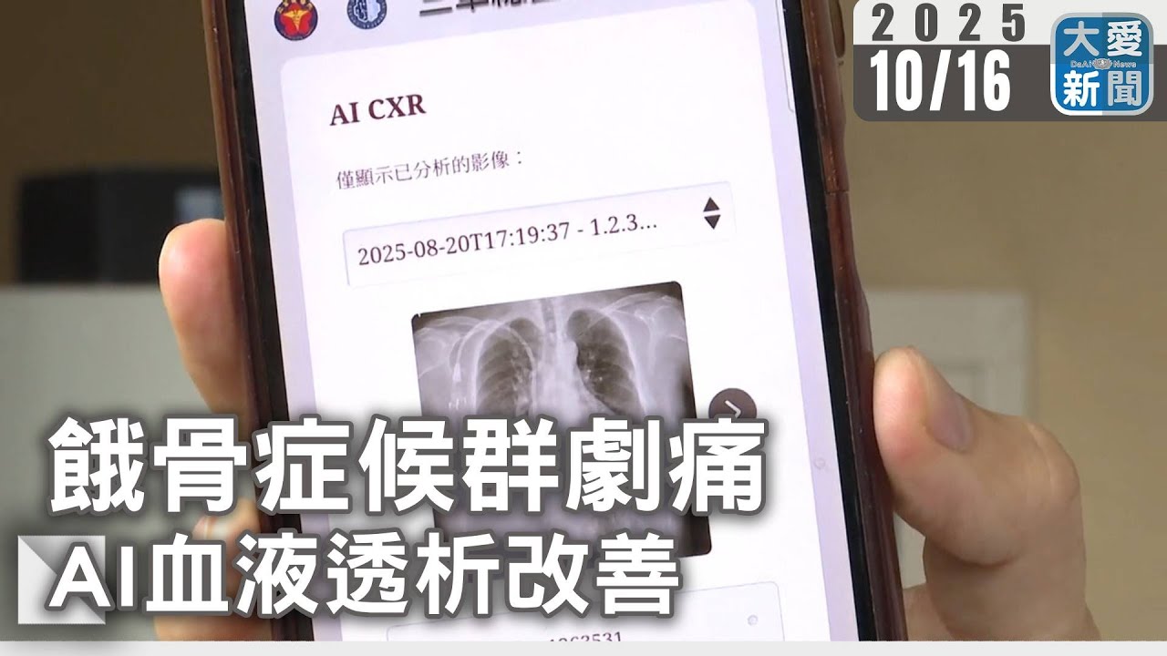 餓骨症候群劇痛 AI血液透析改善｜#大愛新聞 #醫療 #創新