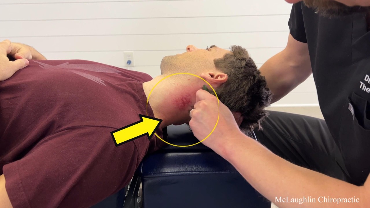 Hurt By Previous Chiropractor 😞 Helping A *FROZEN NECK* Break FREE The Right Way - CRUNCH!