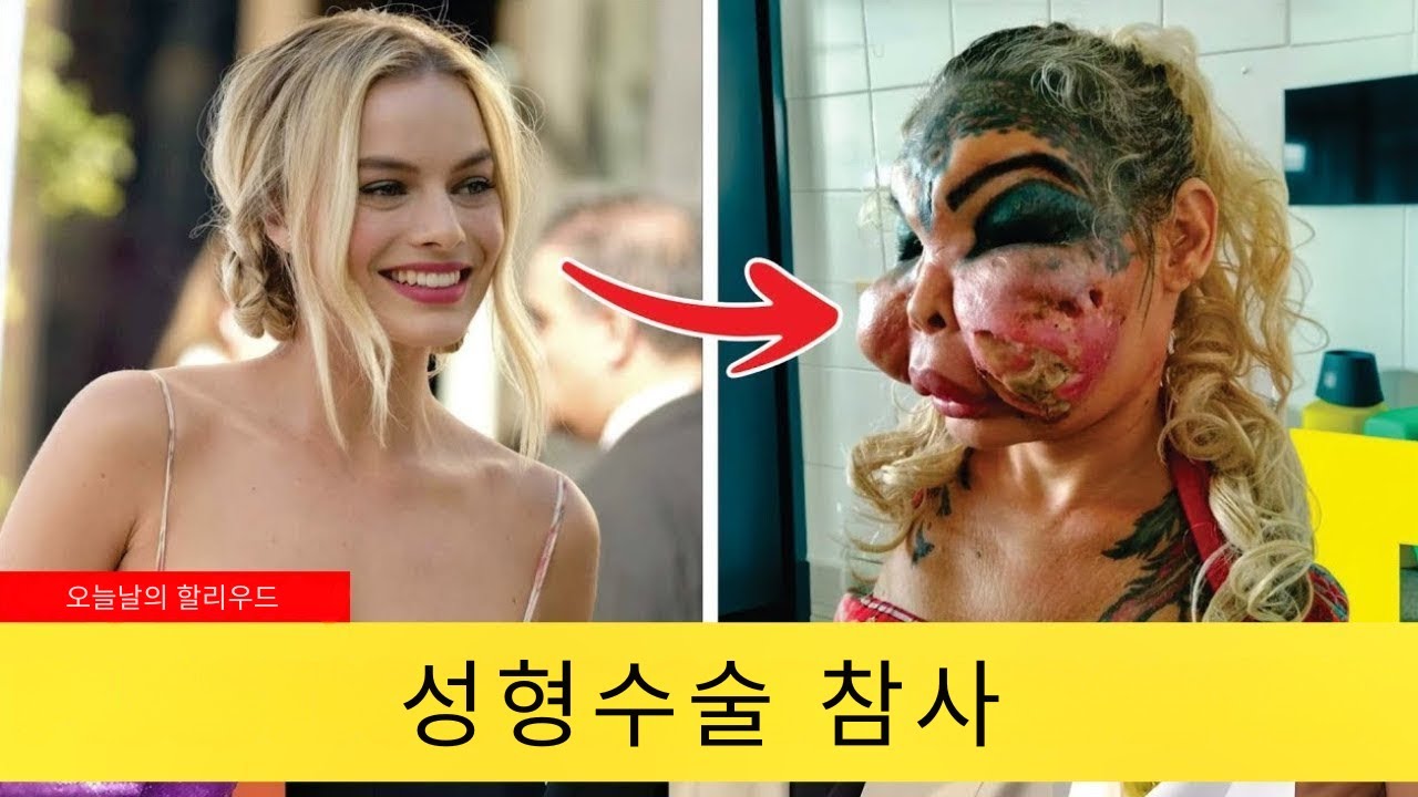 성형 전후가 이렇게 달라졌다고? 유명 연예인 7명의 충격적인 변화｜Then and Now 2025