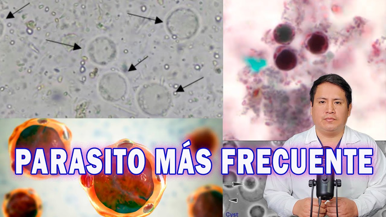 COMO ELIMINAR AL BLASTOCYSTIS HOMINIS MAS OPCIONES