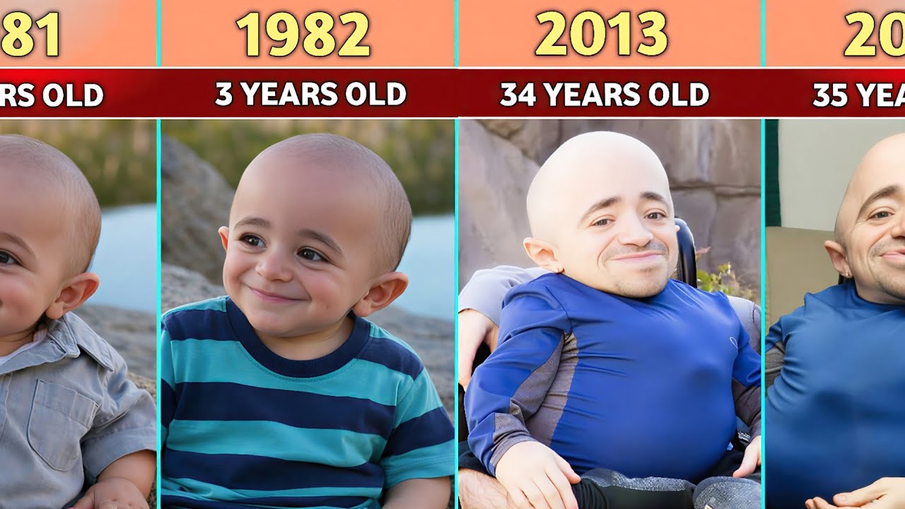 World&rsquo;s Shortest Man (Sean Stephenson) &ndash; Transformation From 0 to 40 Years Old (1979 - 2019)