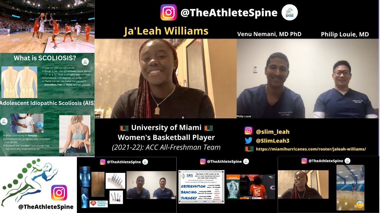 *Guest Athlete* | Ja'Leah Williams - NCAA Women's Basketball | Spine Fusion for Idiopathic Scoliosis