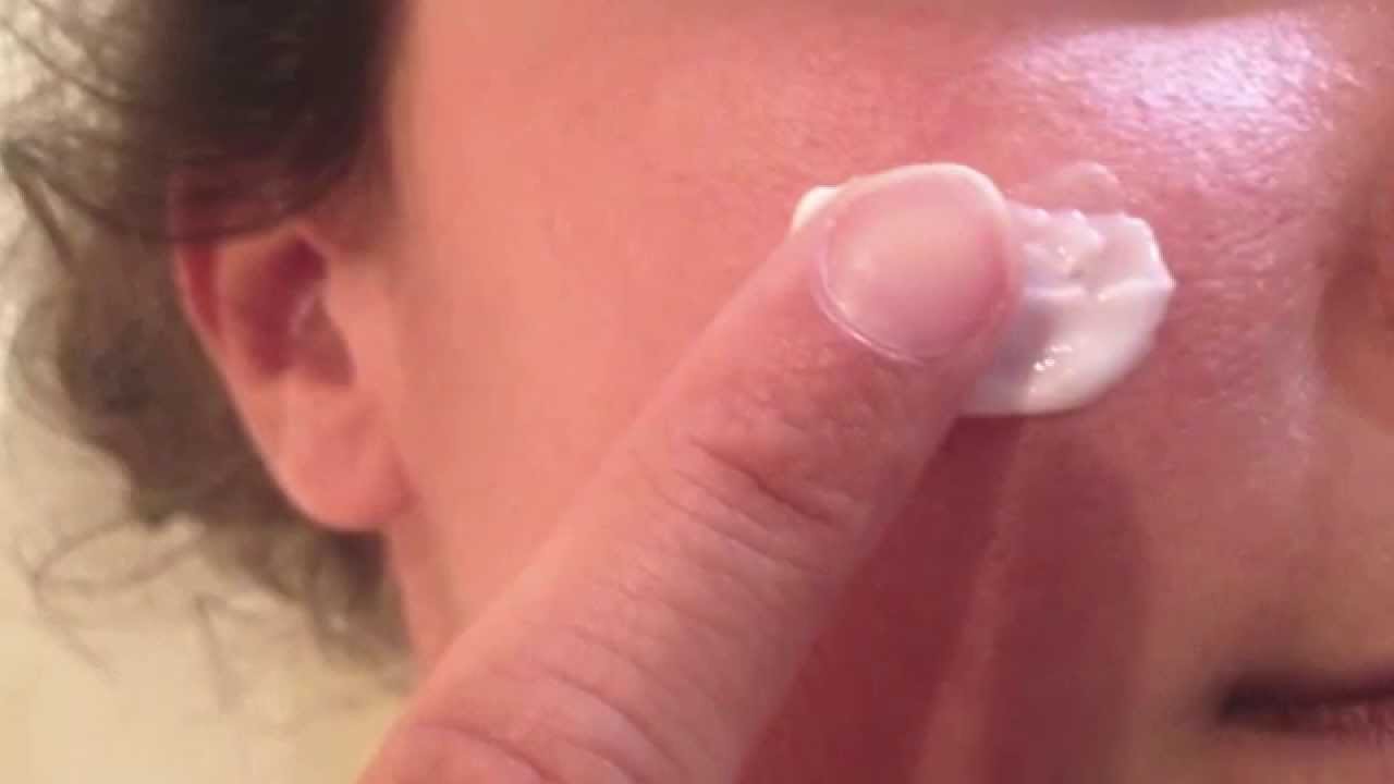 Remedios caseros para granos en la cara