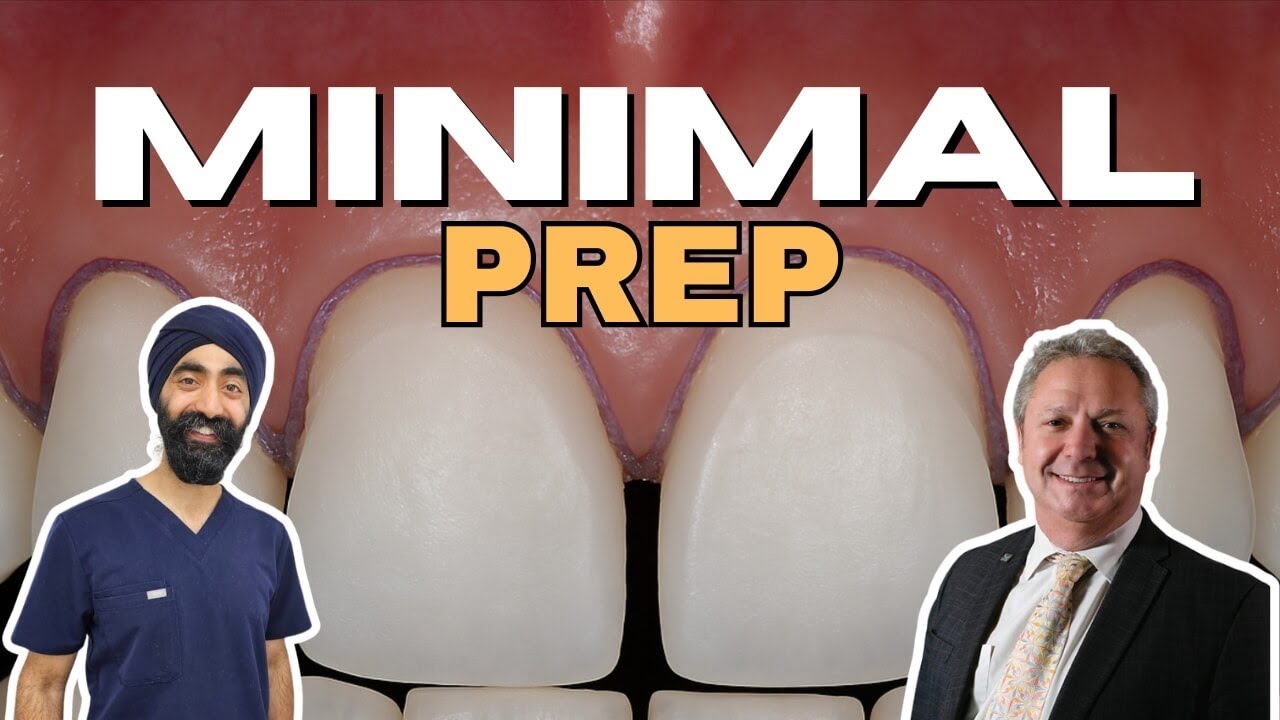 Minimal Preparation Veneers - PDP219