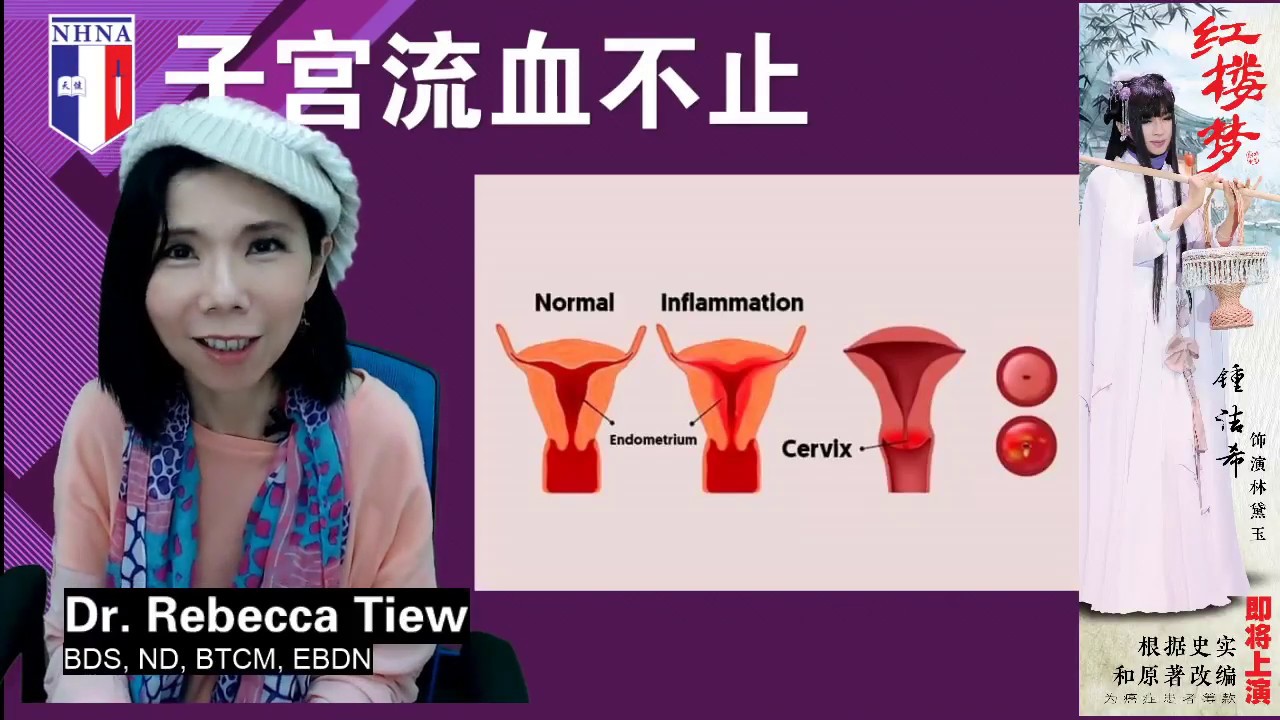 你更健康 161 - 子宫流血不止 - Dr. Rebecca Tiew