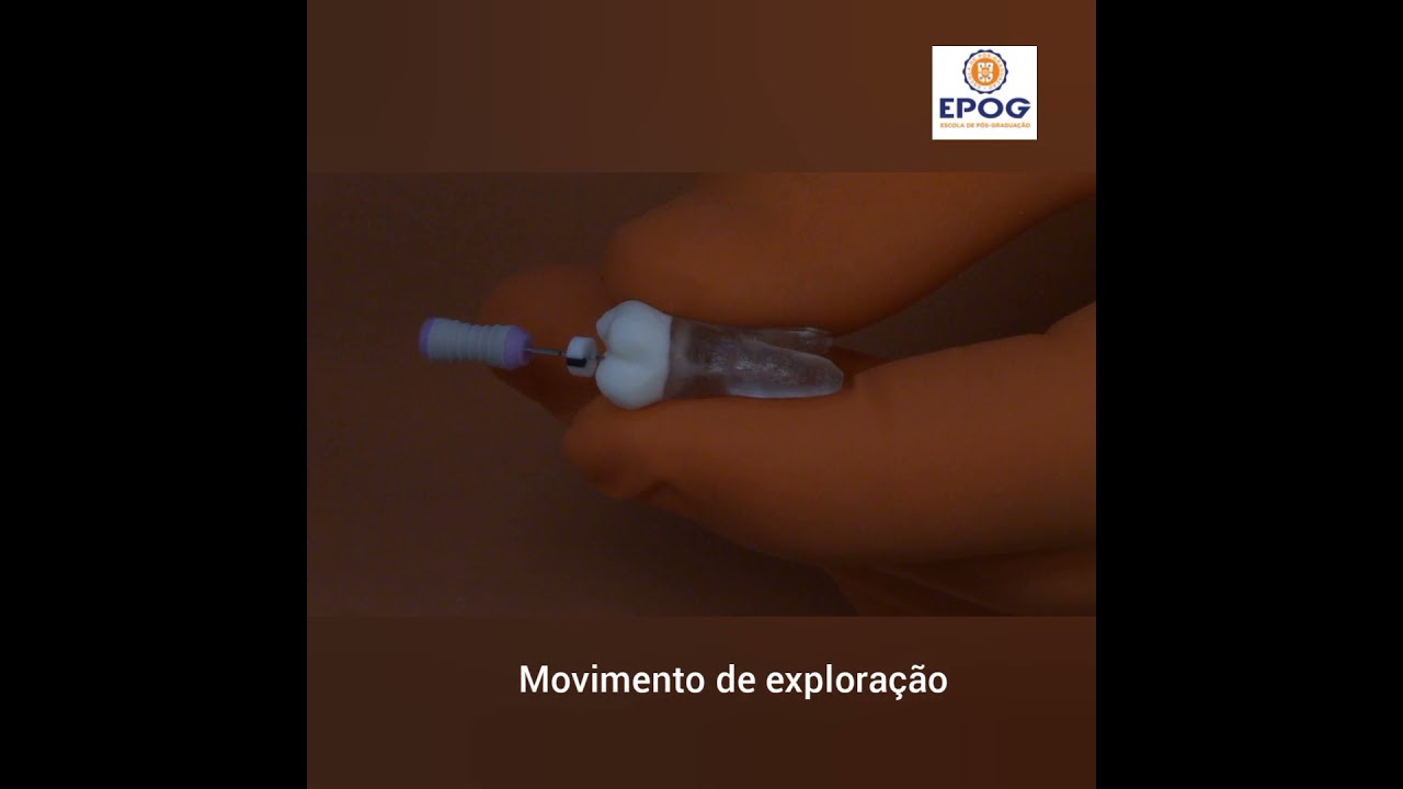 ENDODONTIA - OS 3 PRINCIPAIS MOVIMENTOS MANUAIS REALIZADOS DURANTE A TERAPIA ENDODÔNTICA.
