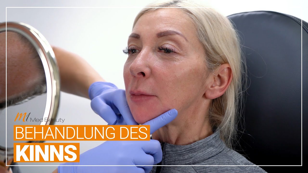 Kinnkorrektur ohne OP | Unterspritzung mit Hyaluron