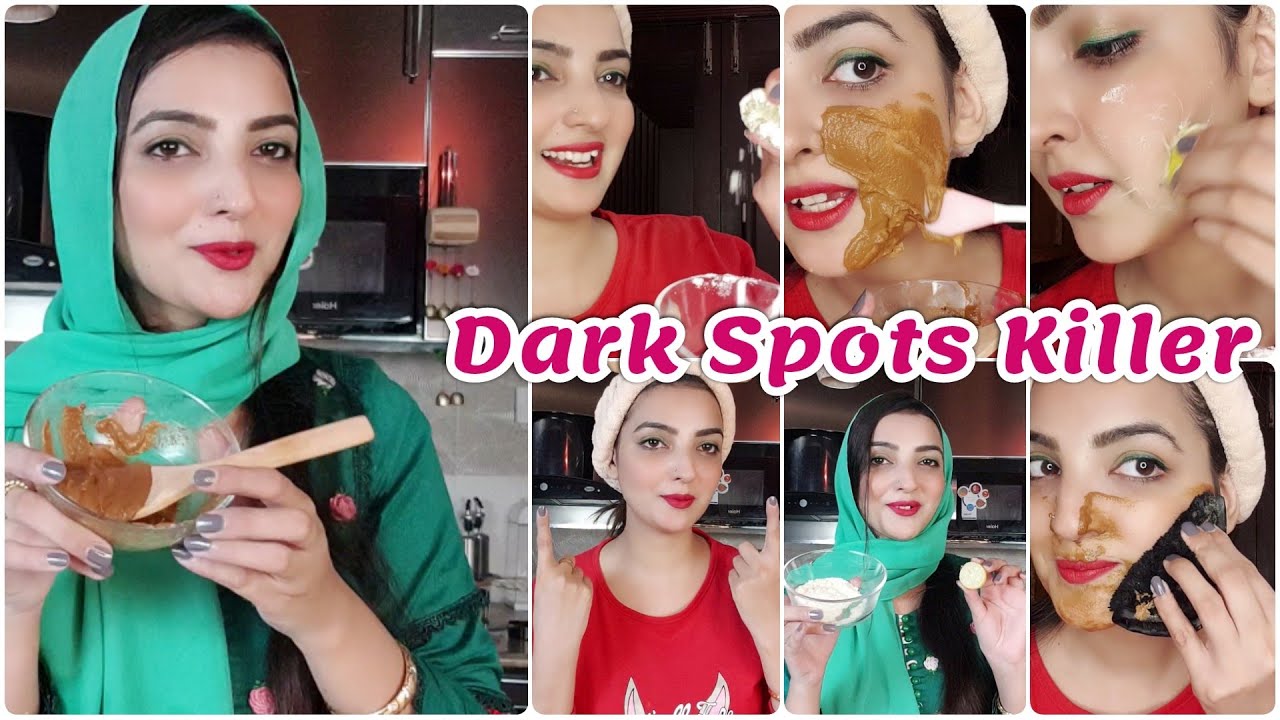 Remove Instant Brown Spots 100% Hyper-pigmentation Get Soft Skin, Fade Dark Spots at Home