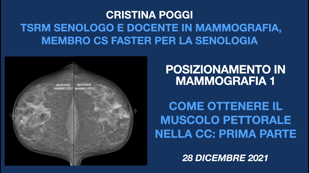 COME OTTENERE IL MUSCOLO PETTORALE NELLA PROIEZIONE CC: PRIMA PARTE