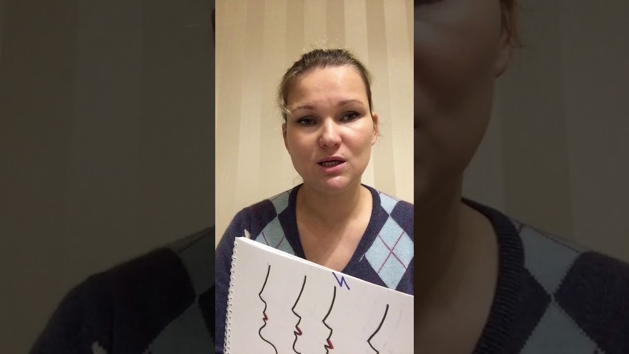 ДВОЙНОЙ ПОДБОРОДОК. Как исправить? Пластика шеи.
