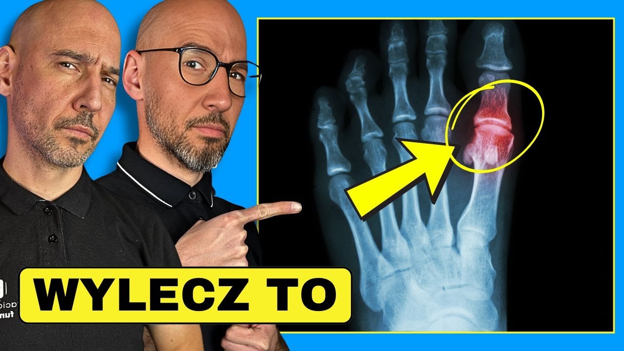 5 Sposobów Na Pokonanie Dny Moczanowej, Które Musisz Znać!