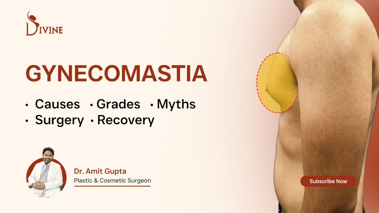 Gynecomastia A–Z in 5 Minutes | Myths, Grades, Surgery & Recovery | Dr Amit Gupta