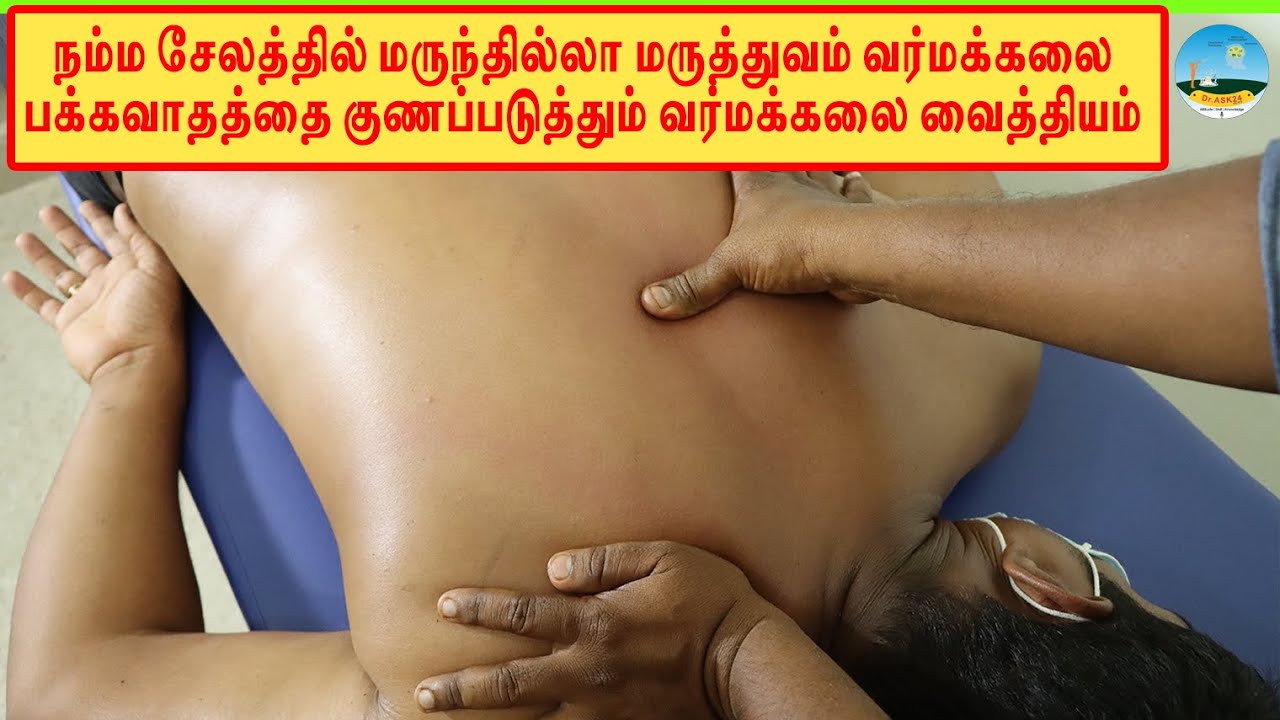 🔴பக்கவாதத்திற்கான வர்மக்கலை சிகிச்சை 🔴எளிய முறையில் வர்மக்கலை பக்கவாதத்திற்கு தீர்வு ☎️9566741052