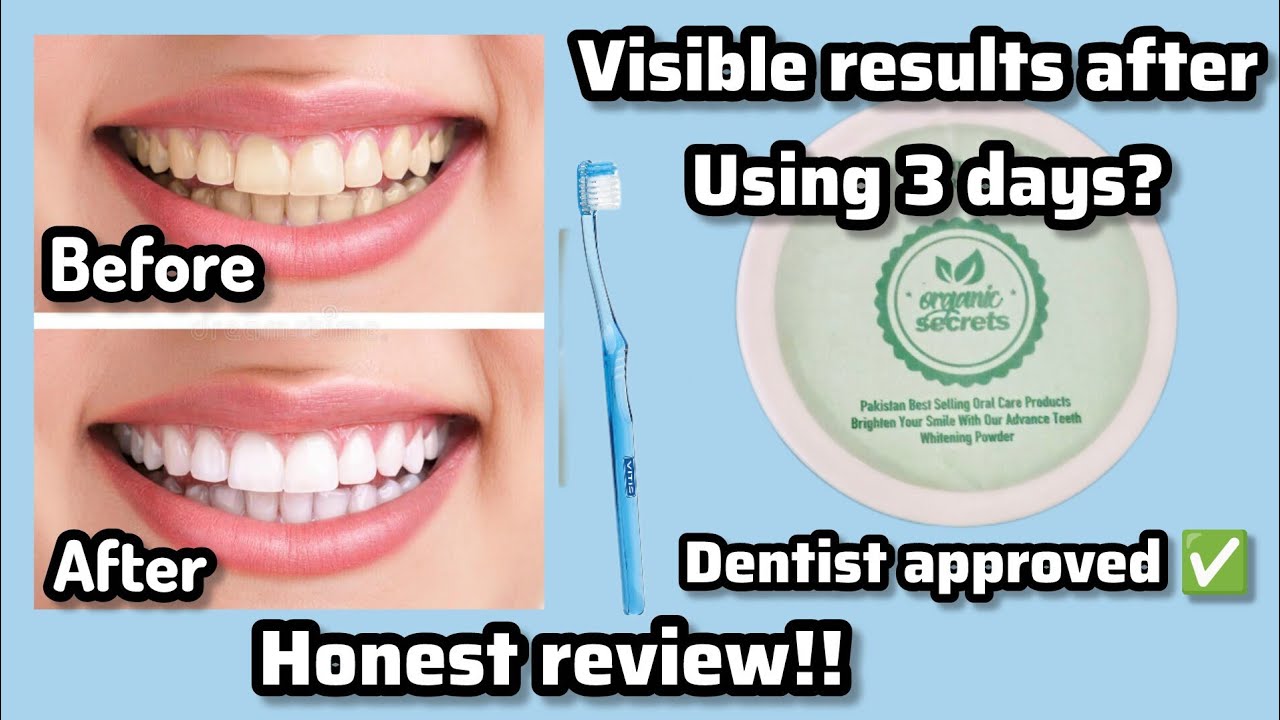 Organic secrets teeth whitening powder review ✨| Honest review| worth or worst| Most demanding video