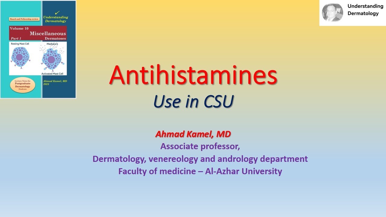 03 Antihistamines in urticaria CSU