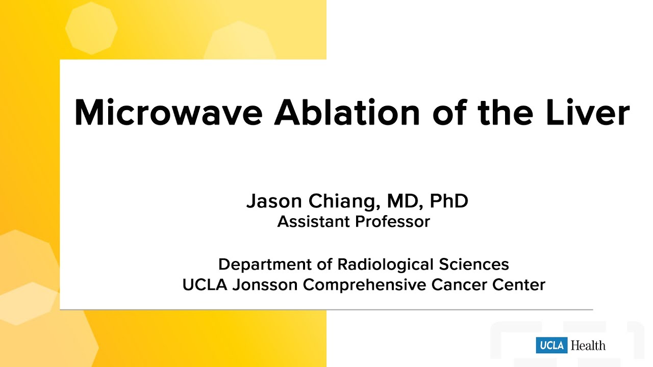Microwave ablation of the liver | UCLA Health