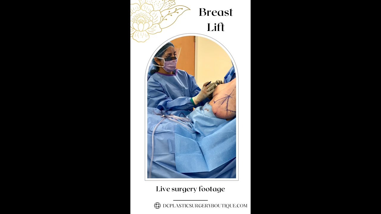 Breast Lift