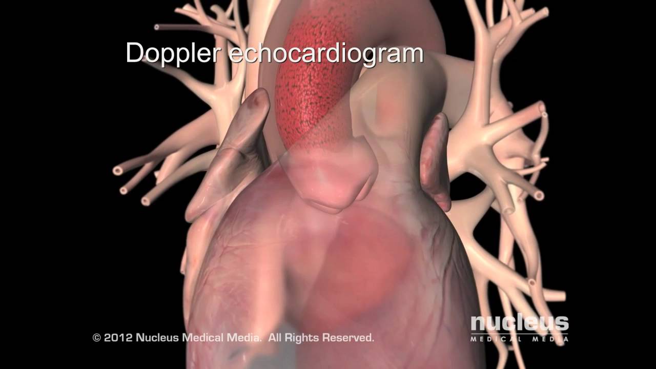Asian Heart Hospital - What is an Echocardiogram (EKG / ECG)?